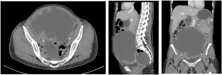 Figure 1