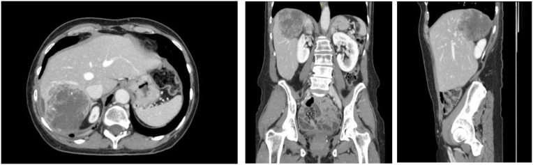 Figure 4