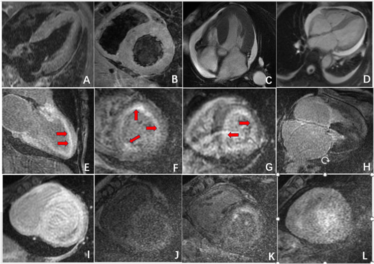 Figure 2