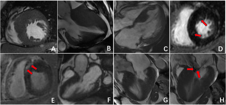 Figure 3