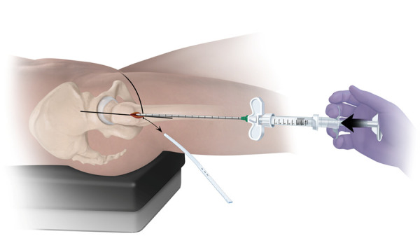 Figure 12