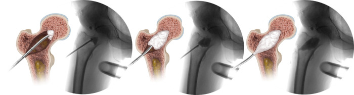 Figure 13