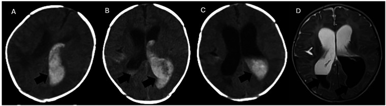 Figure 2