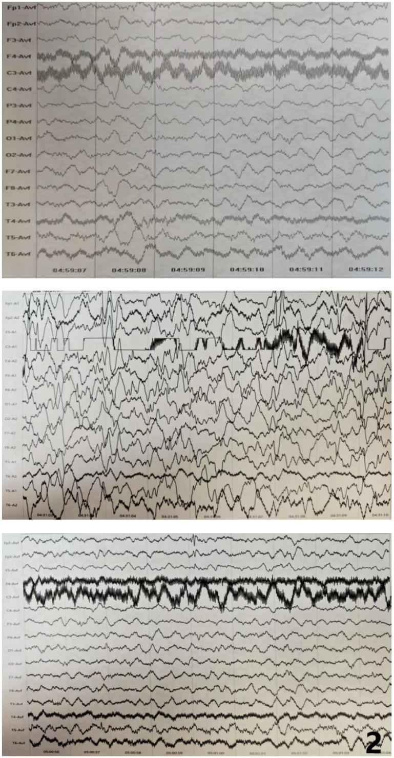 Figure 2