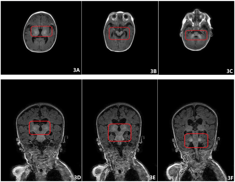 Figure 3