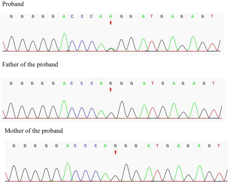 Figure 3
