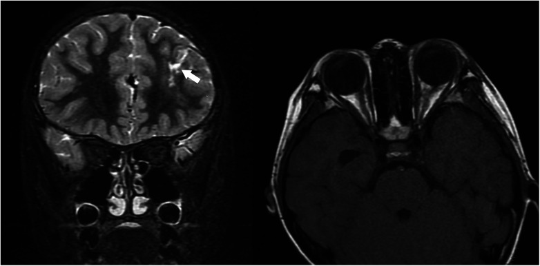 Figure 4