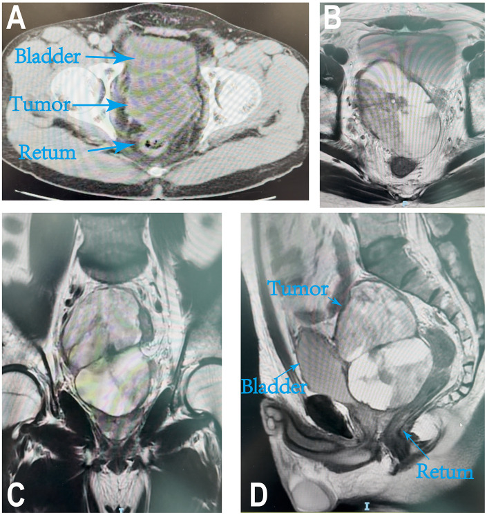 Figure 1