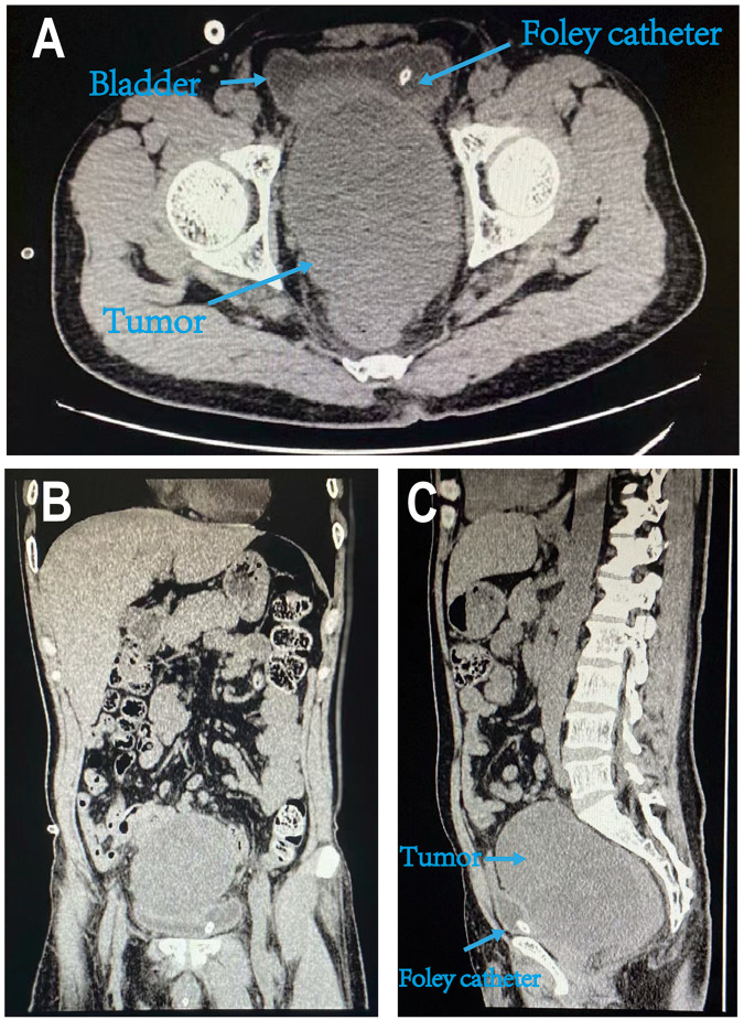 Figure 2