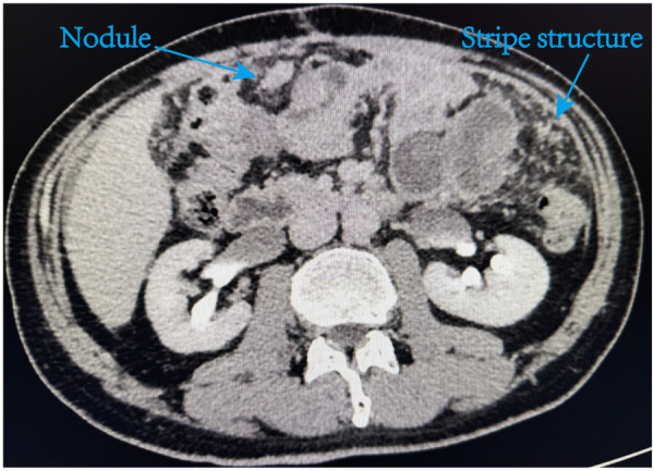 Figure 4