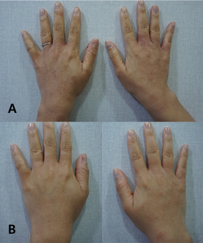 FIGURE 3