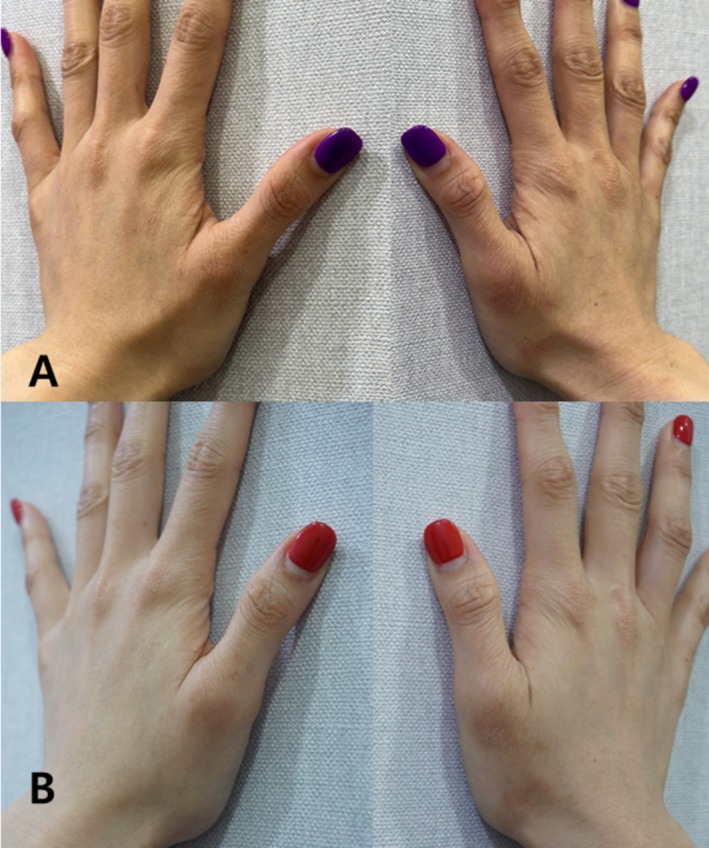 FIGURE 4