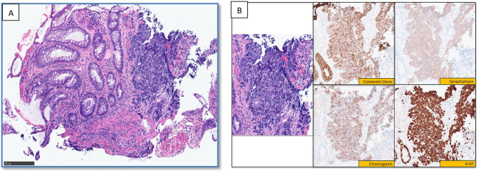 Figure 3