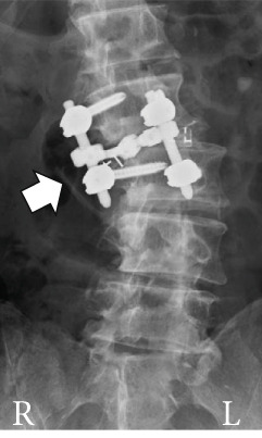 Figure 12
