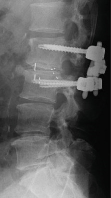 Figure 13