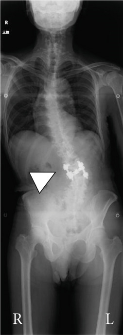 Figure 14