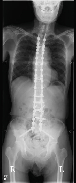 Figure 17