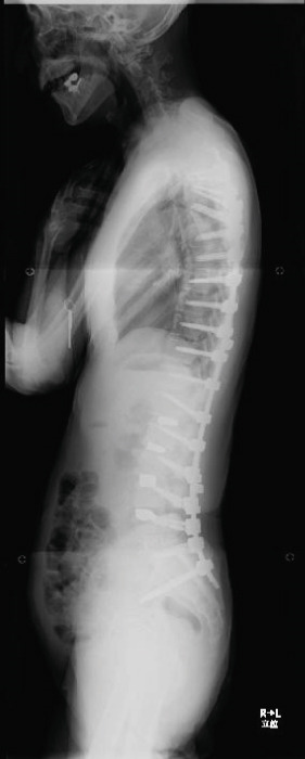 Figure 18