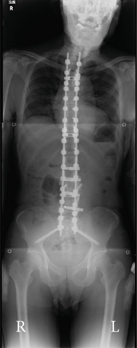 Figure 19