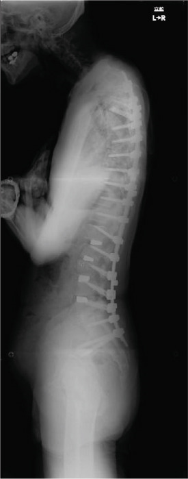 Figure 20