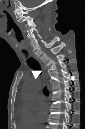 Figure 21