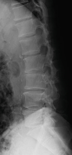 Figure 22