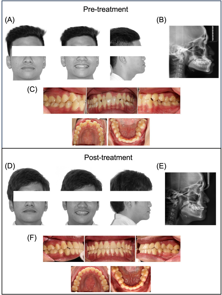 Fig 2
