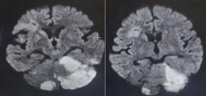 FIGURE 1