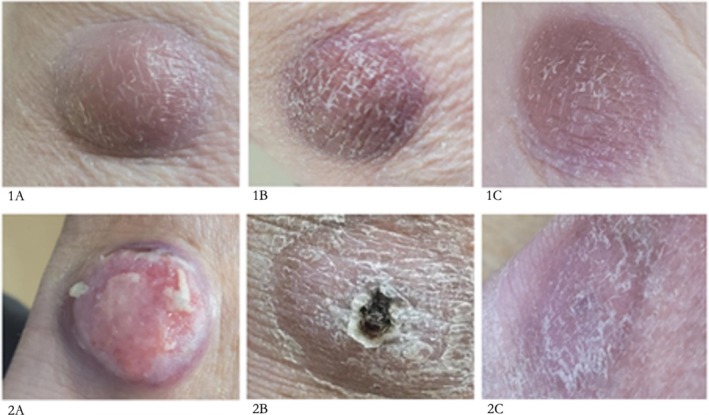 FIGURE 1