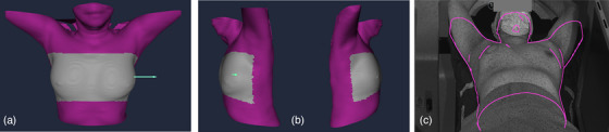 FIGURE 2