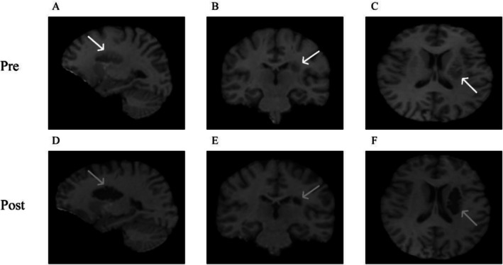 FIGURE 1