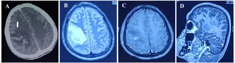 Figure 7