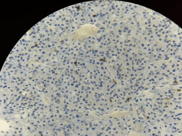 Figure 12