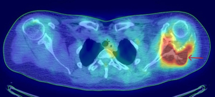 Figure 13