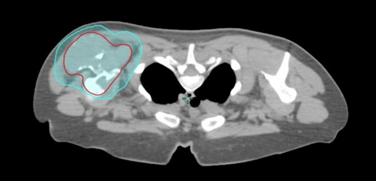 Figure 14