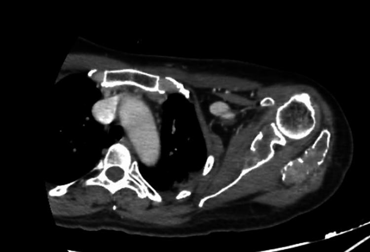 Figure 16