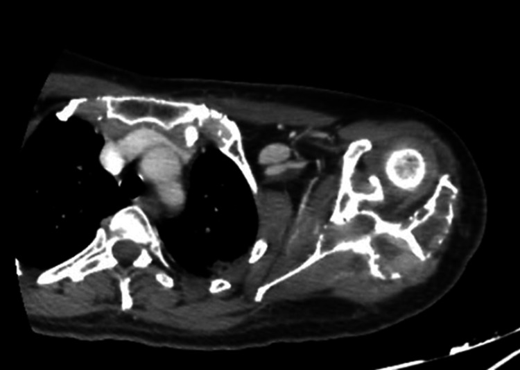 Figure 17