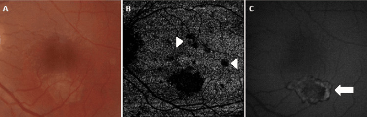Figure 7