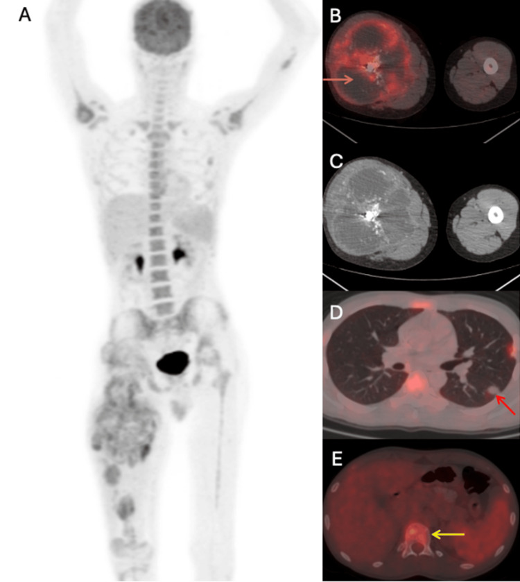 Figure 9