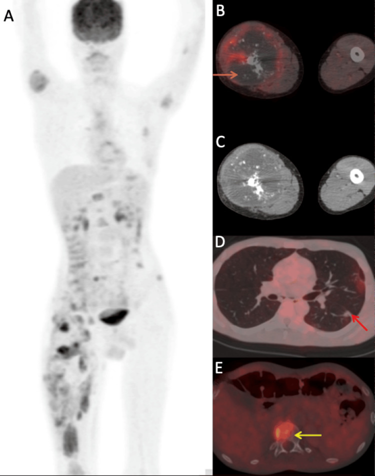 Figure 10