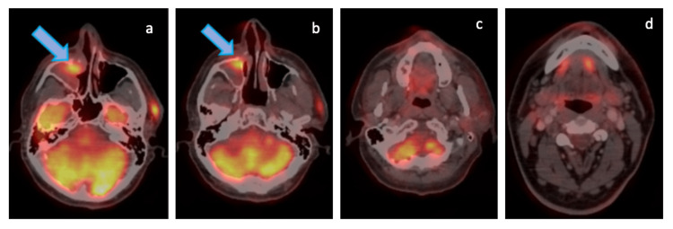 Figure 11