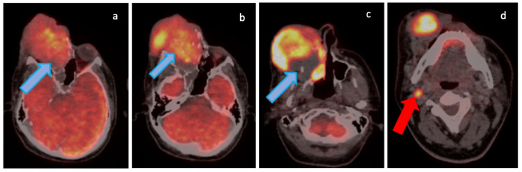 Figure 12