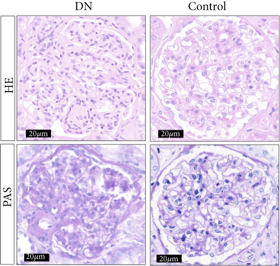 Figure 22