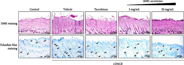 Figure 21