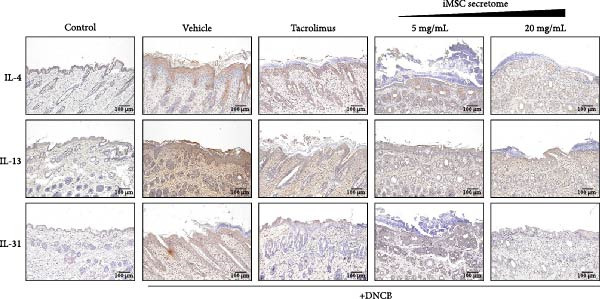 Figure 31