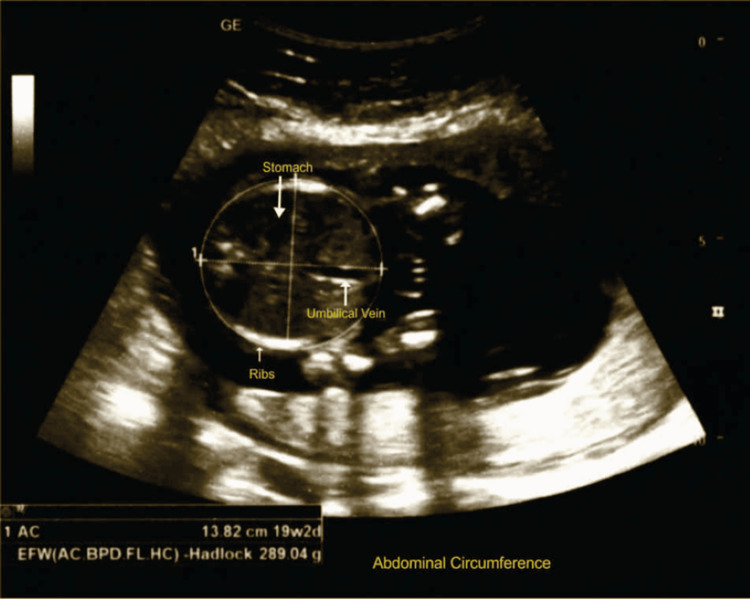 Figure 5