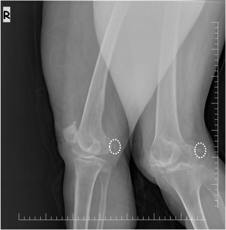 Fig 2