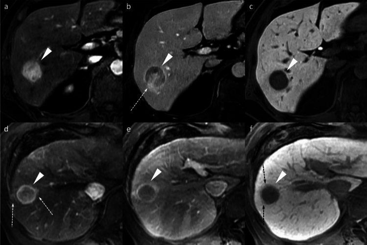 Figure 14