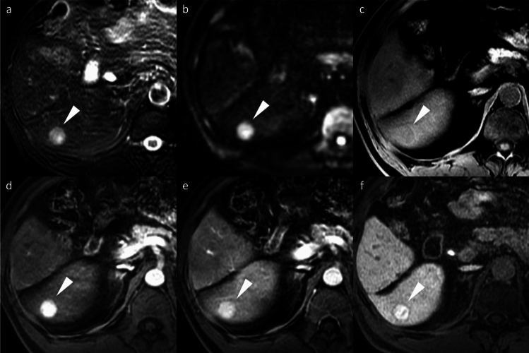 Figure 15