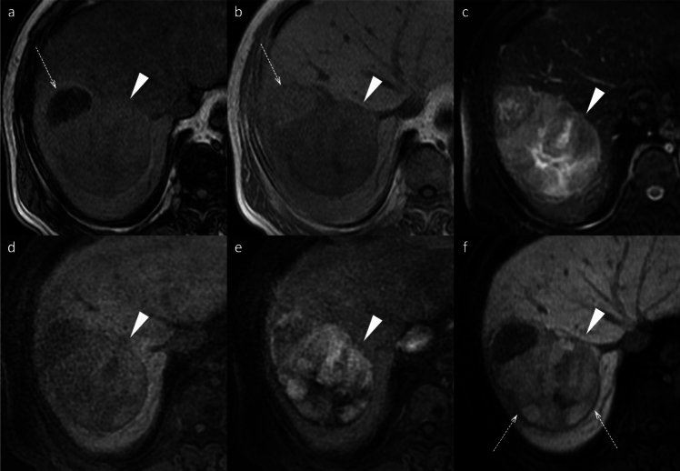 Figure 16